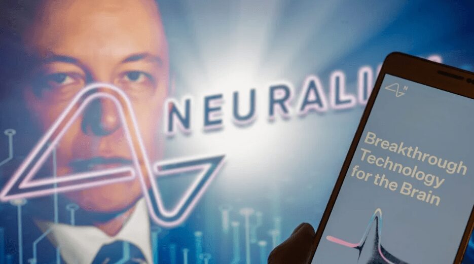 Neuralink's Second Brain Chip Implant