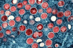 Mpox global health emergency