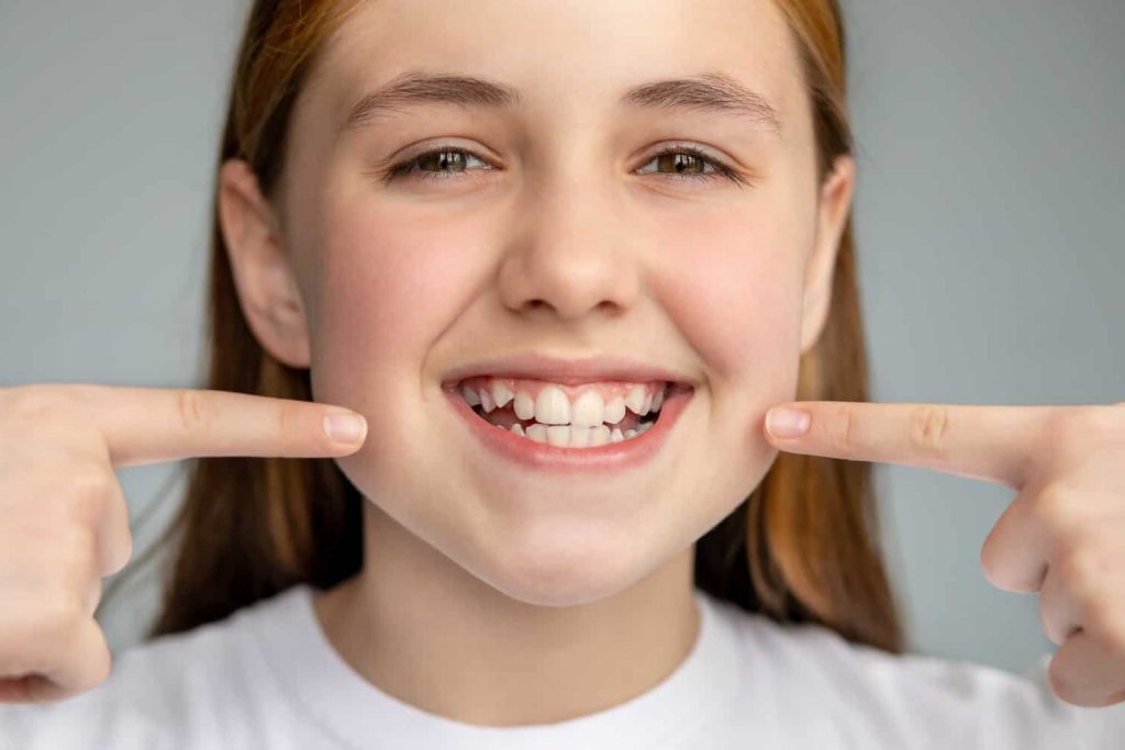 Crooked Teeth