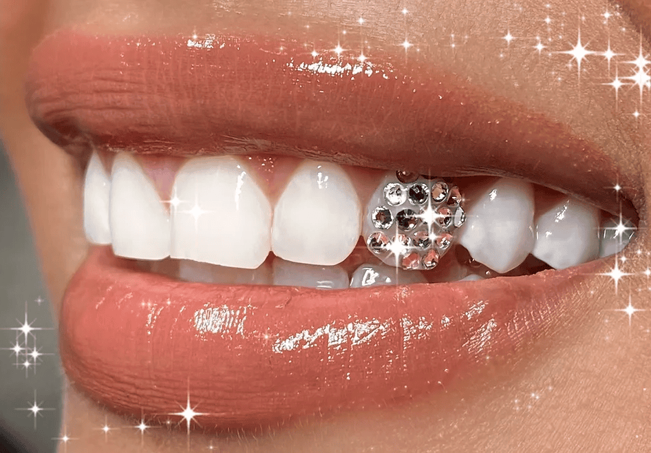 Tooth Bling