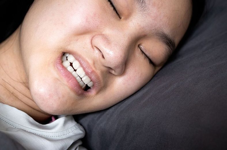 Bruxism Symptoms