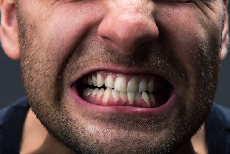 Bruxism Symptoms