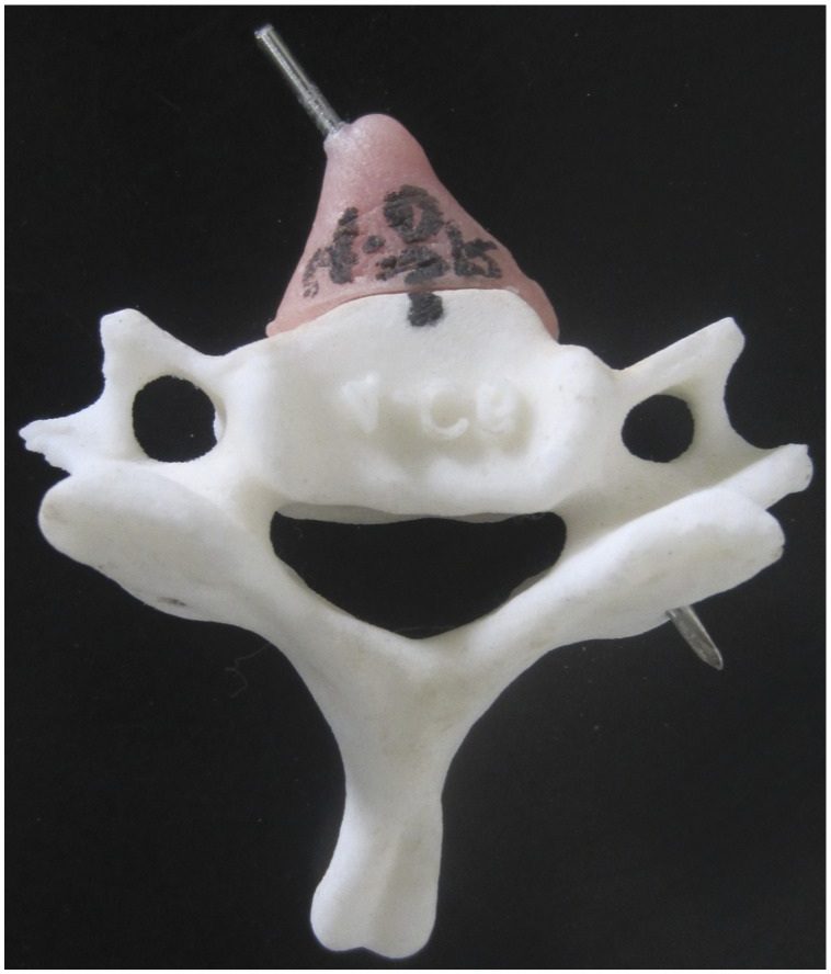 C6 Vertebra Anatomy
